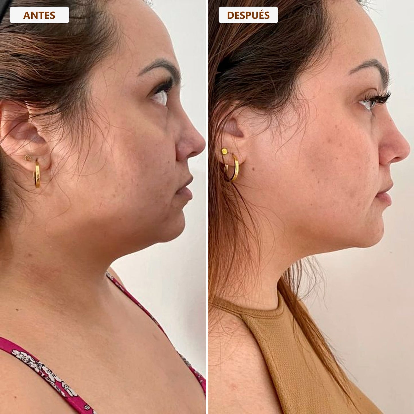 BROCHA FACIAL DE DRENAJE LINFÁTICO - Devuelve el contorno y la suavidad a tu rostro ✨