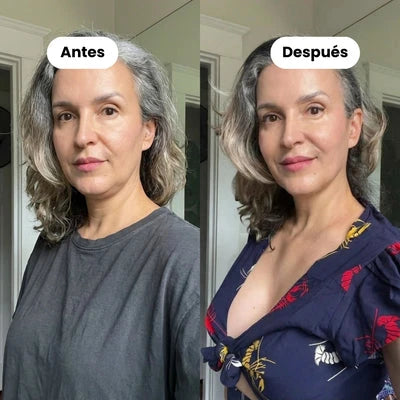 BANDA FACIAL | 30 minutos al día ayudan a reducir la papada desde casa ✅