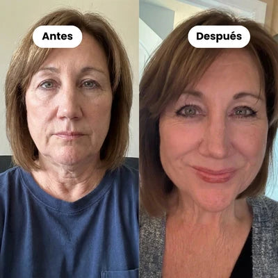 BANDA FACIAL | 30 minutos al día ayudan a reducir la papada desde casa ✅