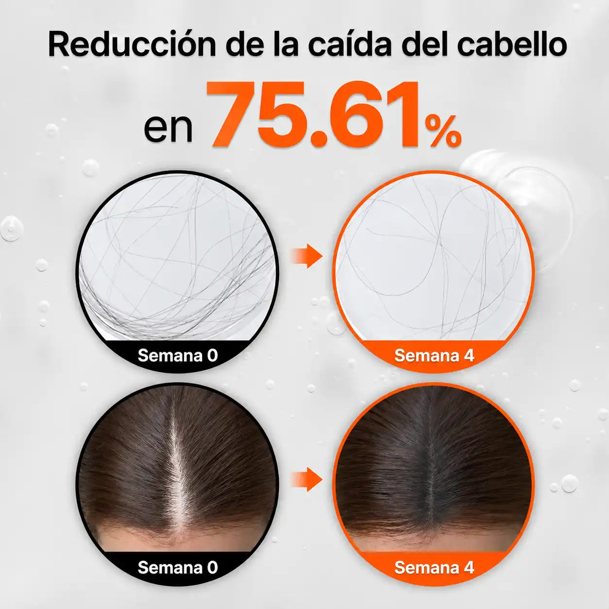 LILYEVE SERUM™ | El sérum de crecimiento que tu cuero cabelludo esperaba 🪮