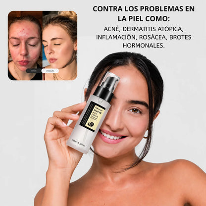 MUCINA DE CARACOL | Sérum con probióticos que restaura, equilibra y renueva tu piel ✨