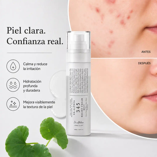 345 RELIEF SPRAY | Ciencia coreana para la pieles con brotes, rosácea y acné inflamatorio ✨