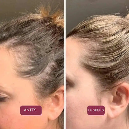 FERRAVITAL™ | Combate la caída del cabello y la fatiga con ferritina avanzada 🧬