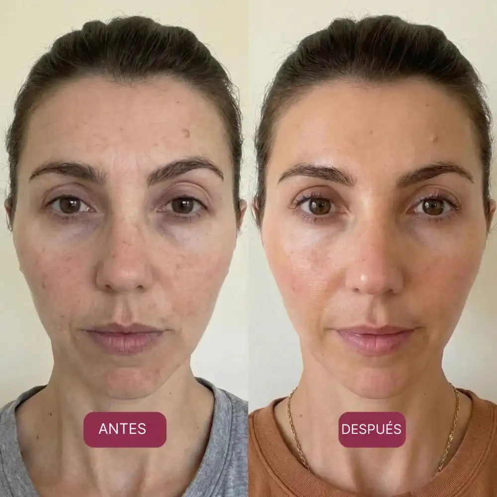 FERRAVITAL™ | Combate la caída del cabello y la fatiga con ferritina avanzada 🧬