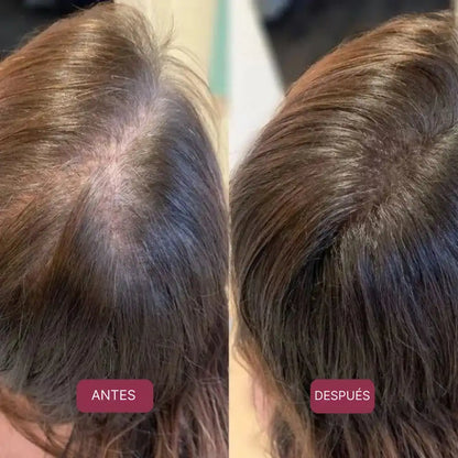 FERRAVITAL™ | Combate la caída del cabello y la fatiga con ferritina avanzada 🧬
