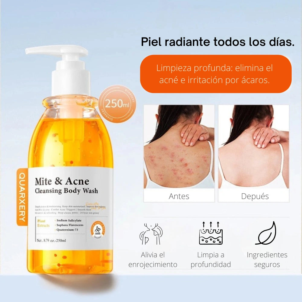 QUARXERY MITE & ACNE® | Jabón liquido corporal de limpieza ultra profunda 🧴