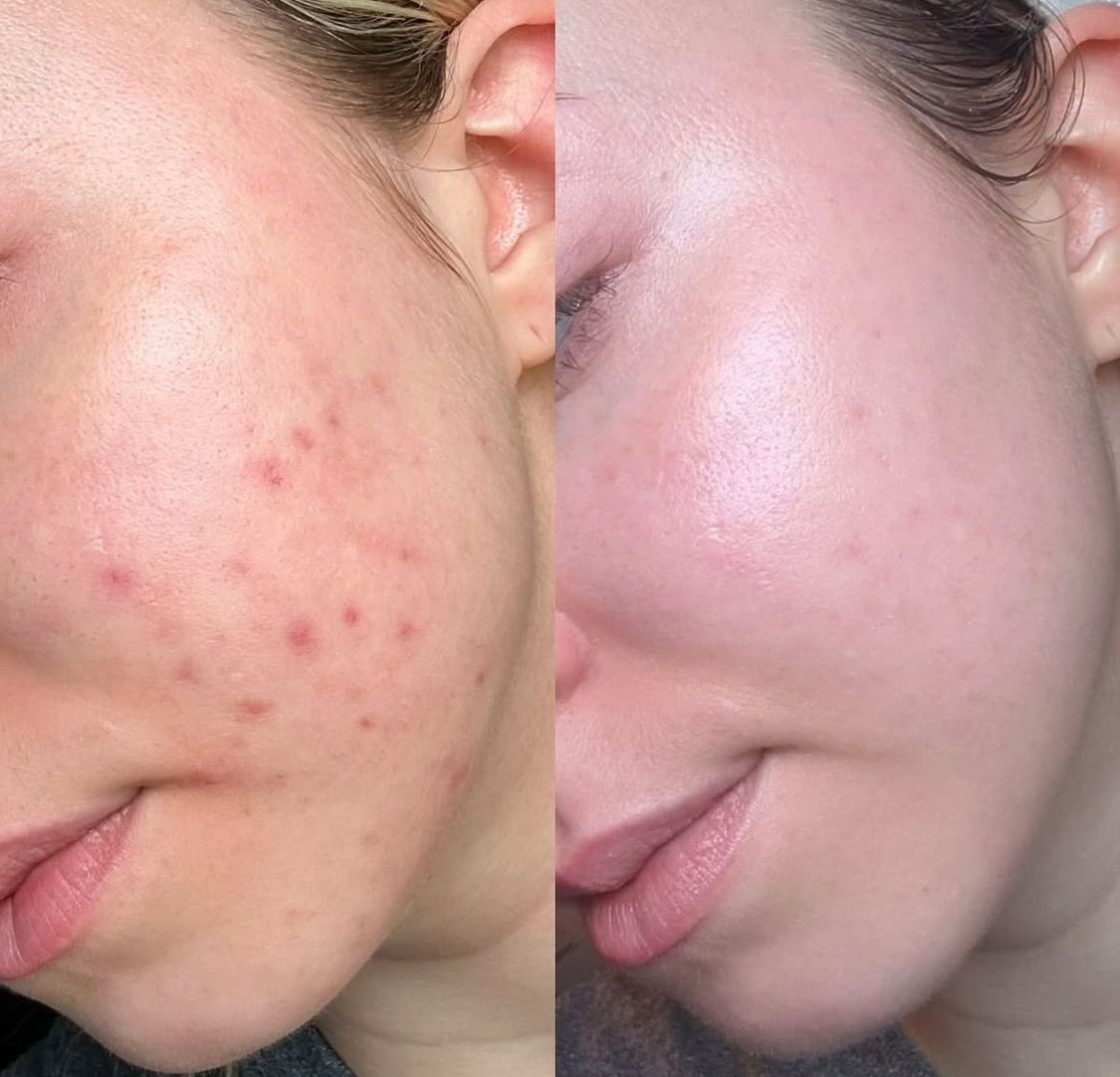 PURITO CREAM® - Crema hidratante certificada, apta para pieles sensibles 🍃🧴